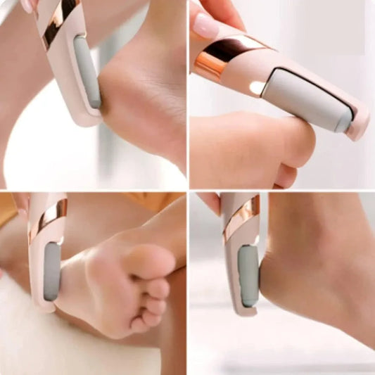 Bos Medicare Surgical Finishing Touch Flawless Pedi Electronic Tool File and Callus Remover, Foot File Callus Remover Too